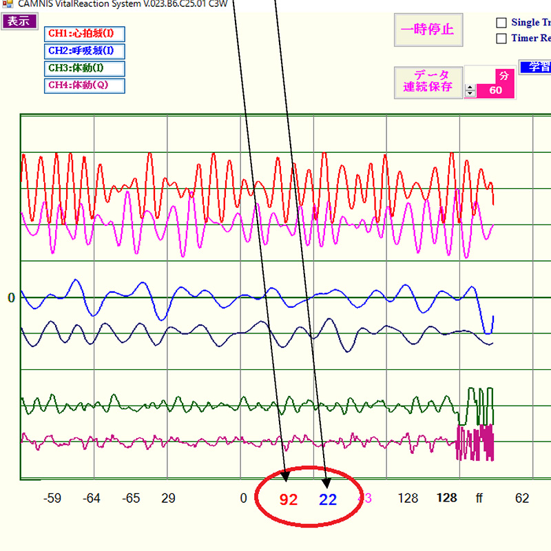 非接触バイタルセンサーの活動量の時系列データについて